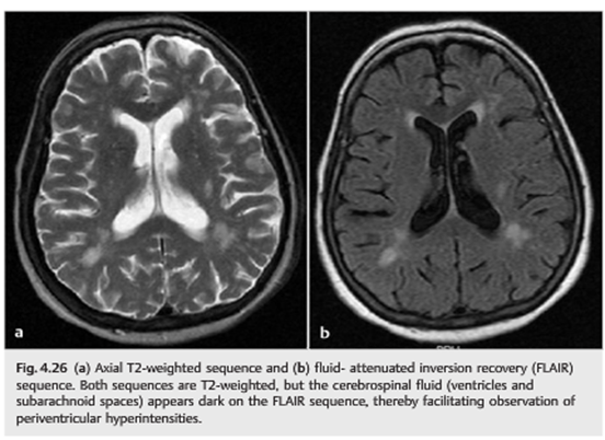 neuro-ophthalmology-question-of-the-week-magnetic-resonance-imaging